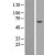 Western Blot: Cytokeratin 6a Lysate [NBL1-12394] - Western Blot experiments. 
Left-Control; Right -Over-expression Lysate for KRT6A